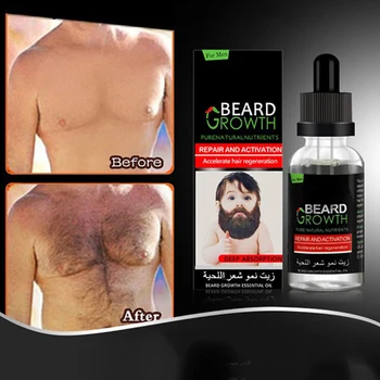 CHORREO de Hombres Líquido Crecimiento de la Barba Aceite Esencial Rápida de Mejorar Bigotes de la cara de la Nutrición Bigote Barba de Reparación de Crecimiento de la Barba de Atención