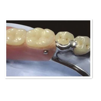 2 Sets/caja de Técnico de Laboratorio Dental Instrumento MK1 archivos Adjuntos de Piezas Dentales Parciales de Metal